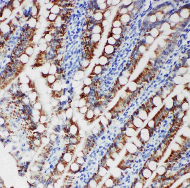 FER Antibody in Immunohistochemistry (Paraffin) (IHC (P))