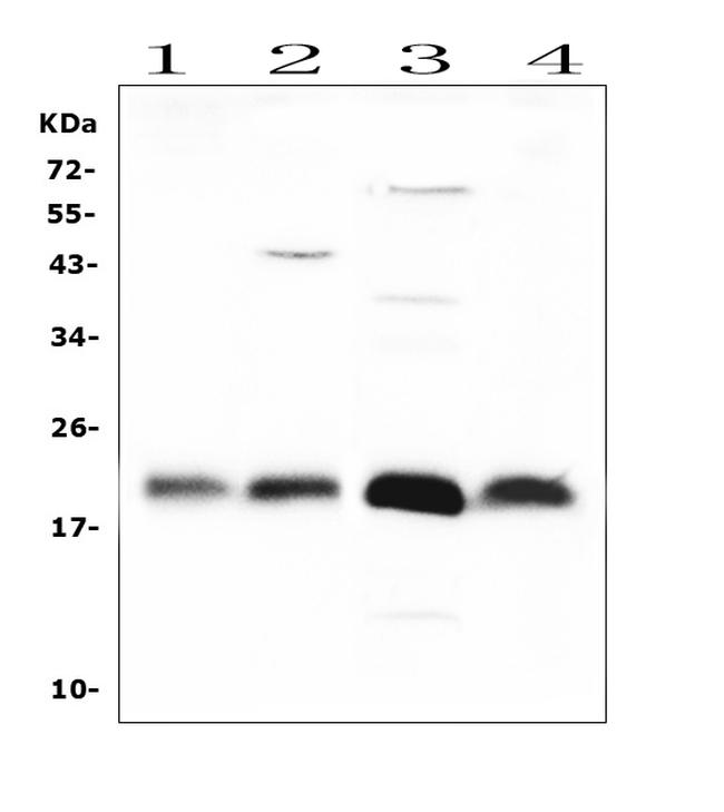 FGF21 Antibody in Western Blot (WB)