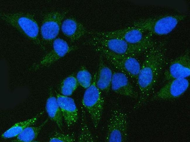 FMRP Antibody in Immunocytochemistry (ICC/IF)