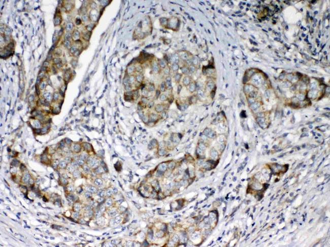 FZD3 Antibody in Immunohistochemistry (Paraffin) (IHC (P))