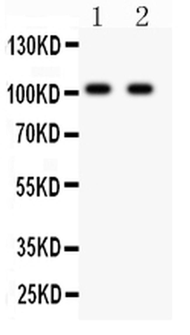 GluR4 Antibody in Western Blot (WB)