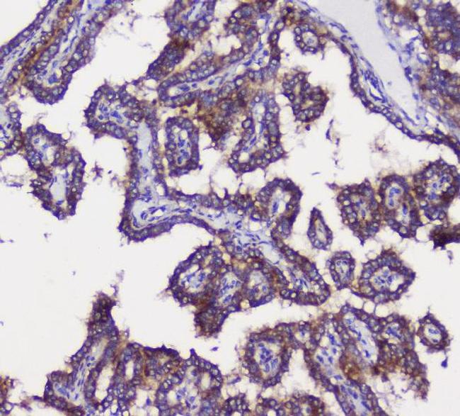 GRIK1 Antibody in Immunohistochemistry (Paraffin) (IHC (P))