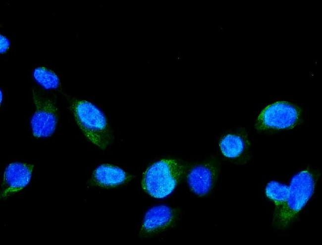 GRK2 Antibody in Immunocytochemistry (ICC/IF)