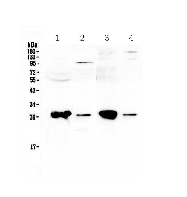 GSTT1 Antibody in Western Blot (WB)