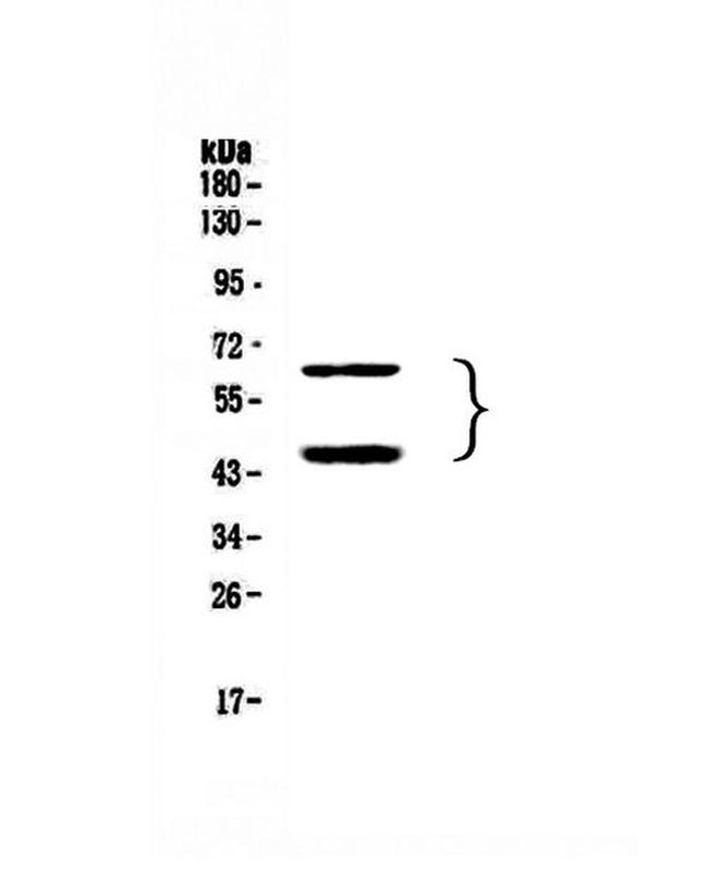 TIM-3 Antibody in Western Blot (WB)