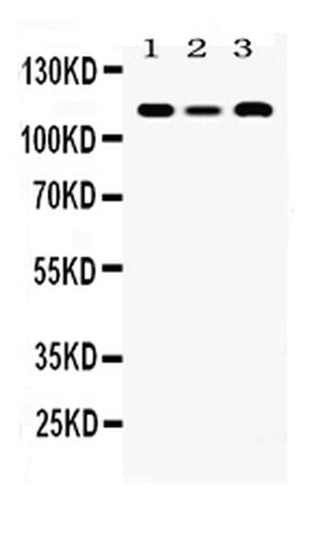 HLTF Antibody in Western Blot (WB)