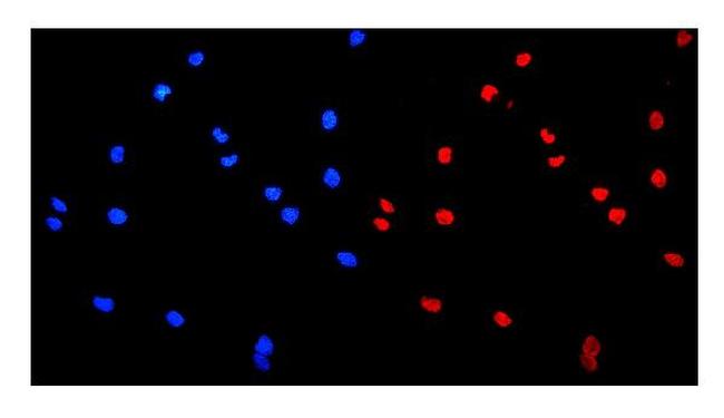 hnRNP A1 Antibody in Immunocytochemistry (ICC/IF)