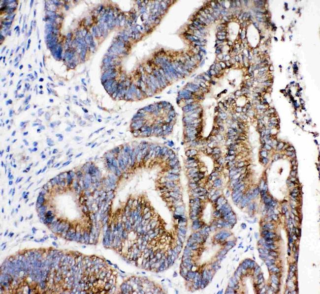 HSD17B4 Antibody in Immunohistochemistry (Paraffin) (IHC (P))