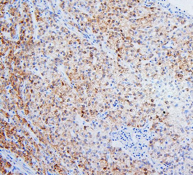 HSD17B6 Antibody in Immunohistochemistry (Paraffin) (IHC (P))