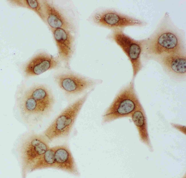 HSPA9 Antibody in Immunocytochemistry (ICC/IF)