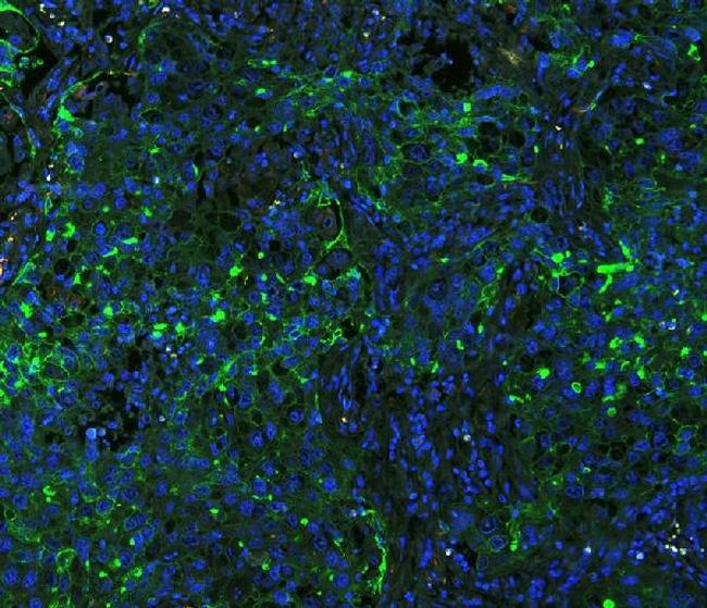 ICAM-1 (CD54) Antibody in Immunohistochemistry (Paraffin) (IHC (P))