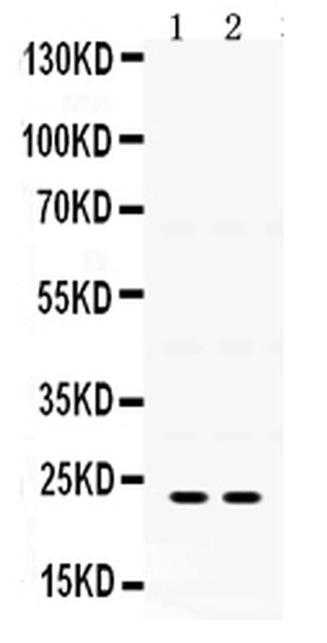 IGFBP5 Antibody in Western Blot (WB)