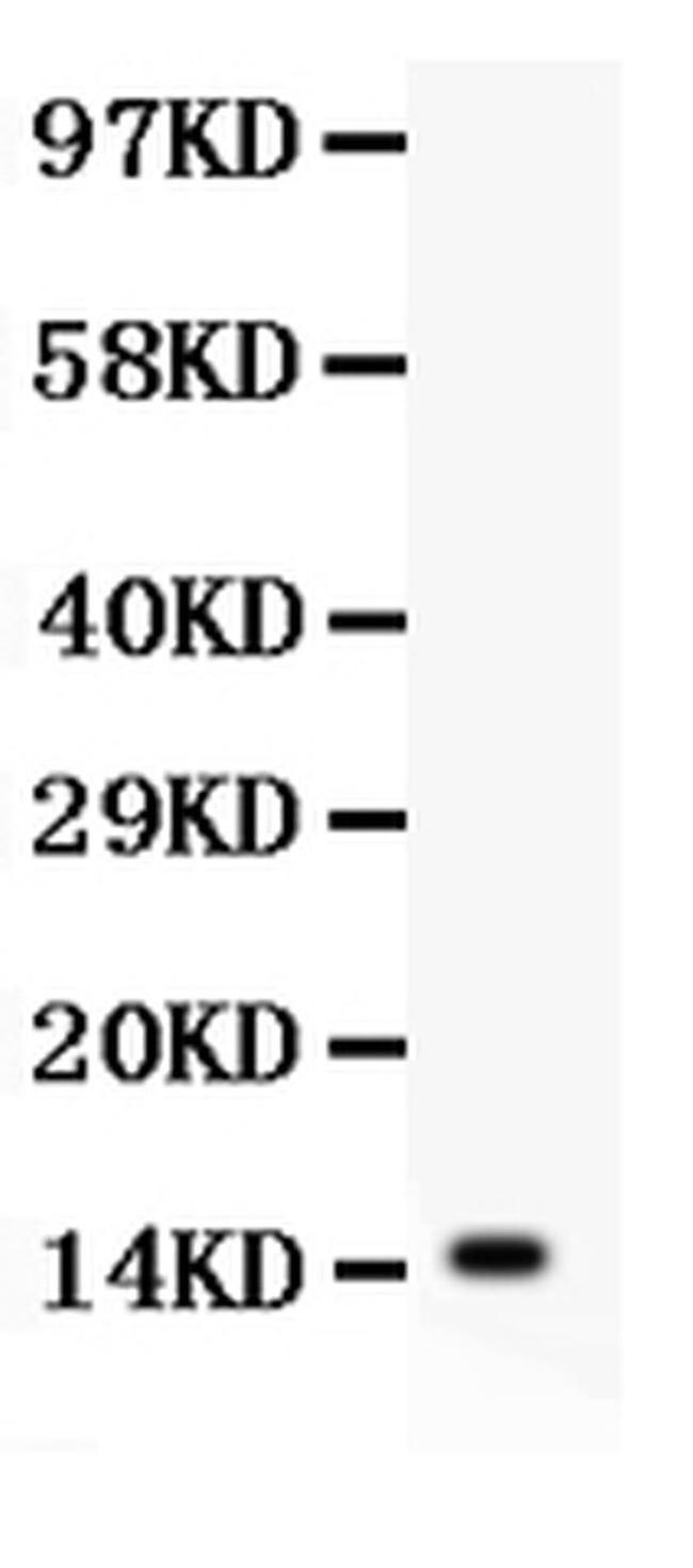 IL-15 Antibody in Western Blot (WB)