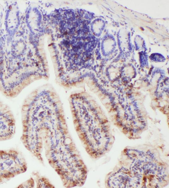 IL-18 Antibody in Immunohistochemistry (Paraffin) (IHC (P))