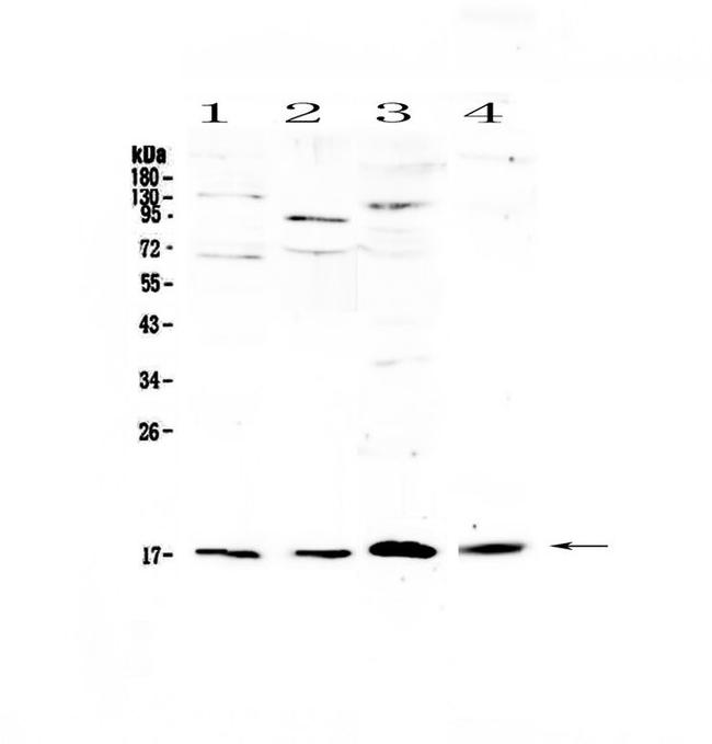 IL1F10 Antibody in Western Blot (WB)