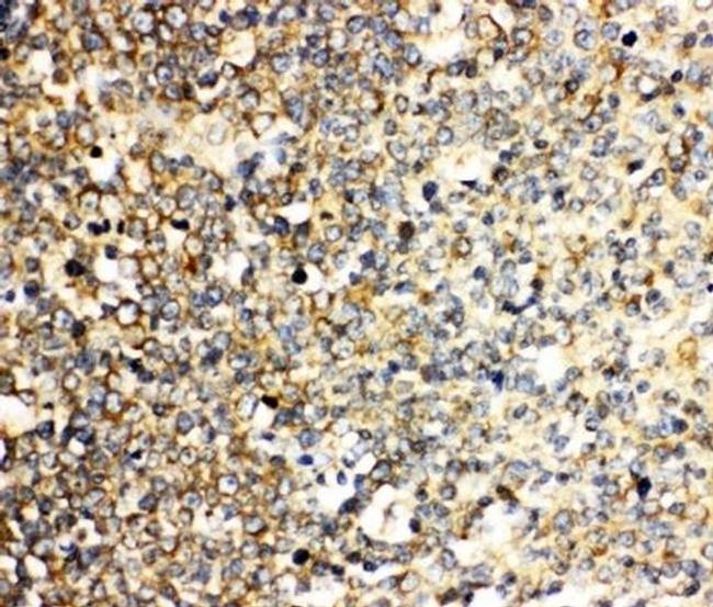 IL-3 Antibody in Immunohistochemistry (Paraffin) (IHC (P))