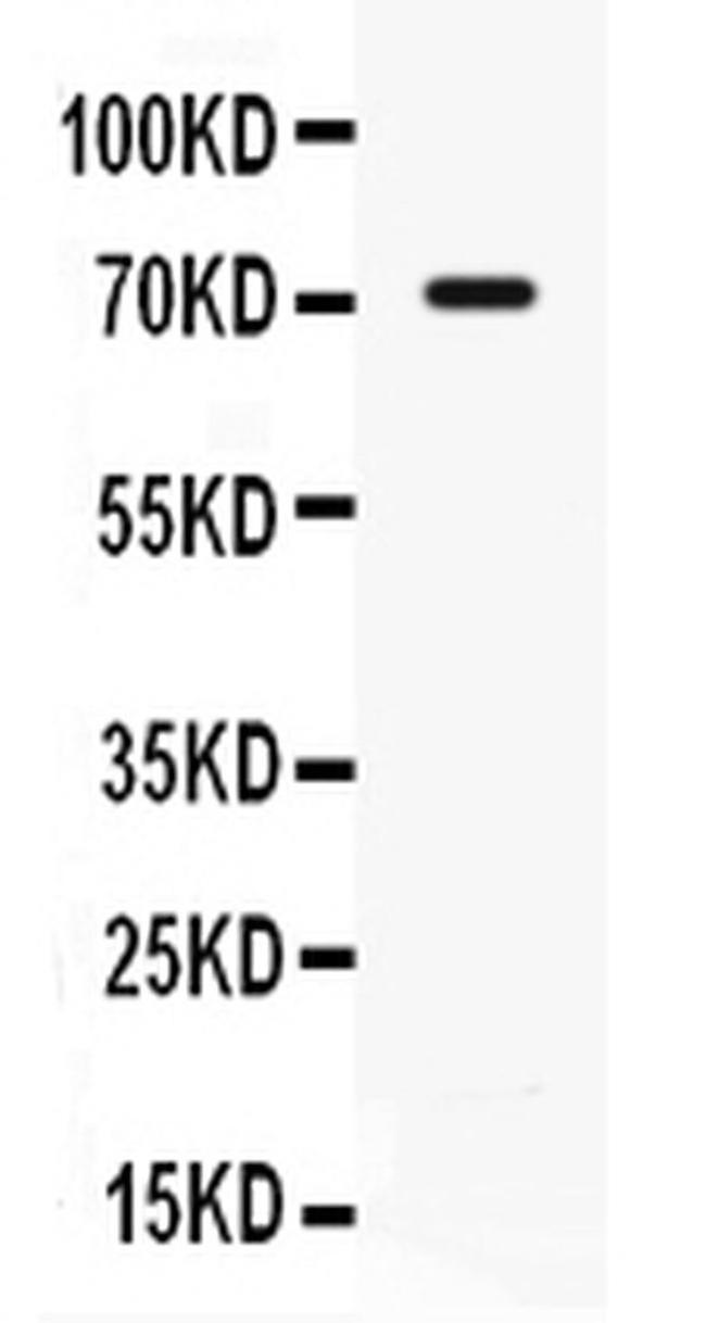 CD127 Antibody in Western Blot (WB)