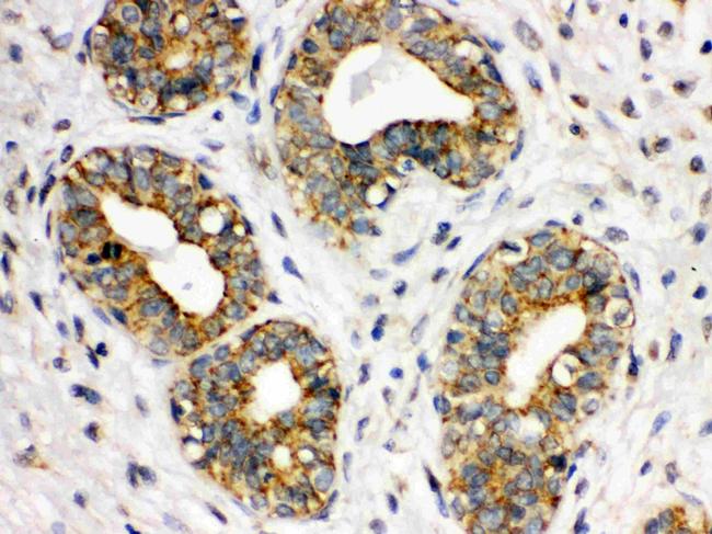 CD41 Antibody in Immunohistochemistry (Paraffin) (IHC (P))