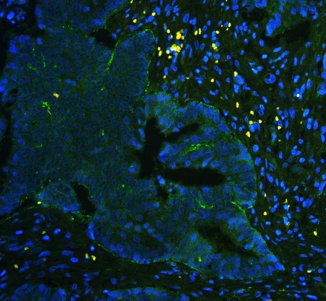 CD49e (Integrin alpha 5) Antibody in Immunohistochemistry (Paraffin) (IHC (P))