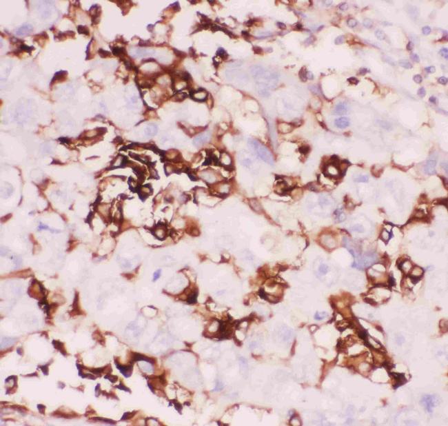 CD18 Antibody in Immunohistochemistry (Paraffin) (IHC (P))