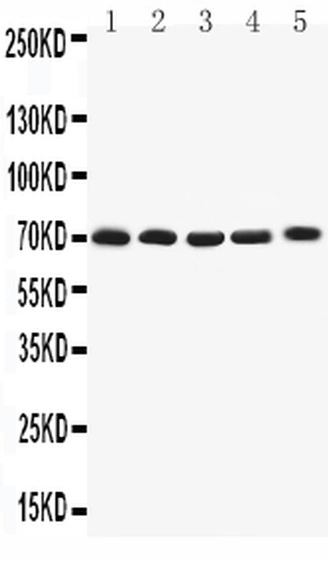 KV1.4 (KCNA4) Antibody in Western Blot (WB)