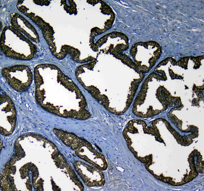 Kallikrein 2 Antibody in Immunohistochemistry (Paraffin) (IHC (P))