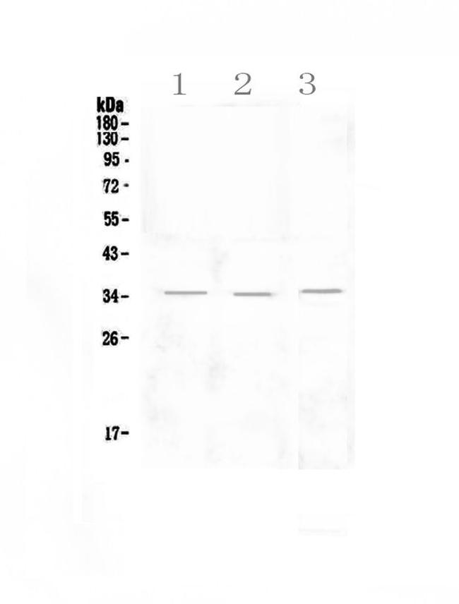 NKG2D (CD314) Antibody in Western Blot (WB)