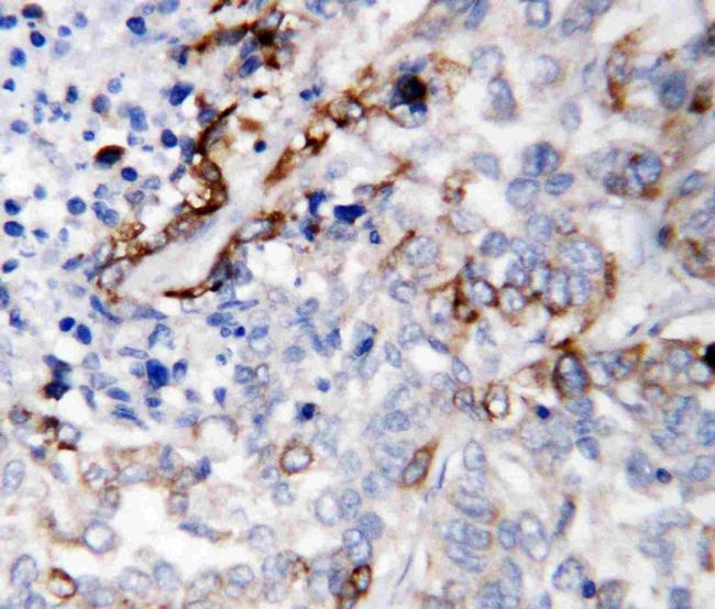 Laminin gamma-2 Antibody in Immunohistochemistry (Paraffin) (IHC (P))