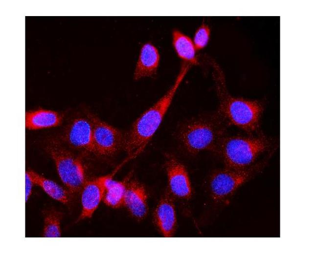 LCK Antibody in Immunocytochemistry (ICC/IF)