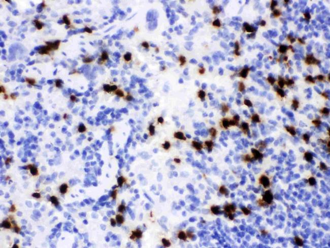 NGAL Antibody in Immunohistochemistry (Paraffin) (IHC (P))