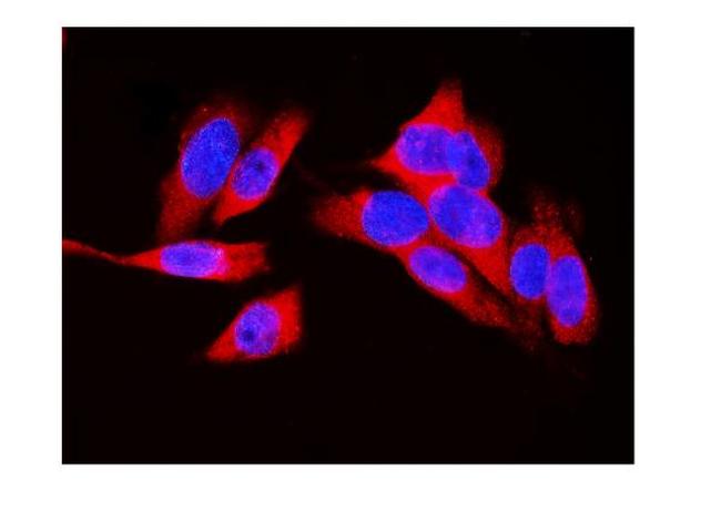 LDHA Antibody in Immunocytochemistry (ICC/IF)