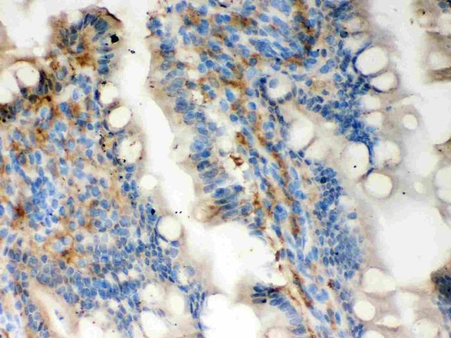 Galectin 3 Antibody in Immunohistochemistry (Paraffin) (IHC (P))