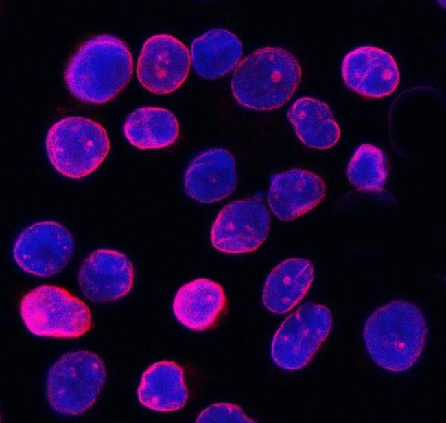 Lamin B1 Antibody in Immunocytochemistry (ICC/IF)