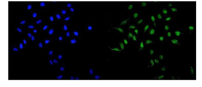 MAD1 Antibody in Immunocytochemistry (ICC/IF)