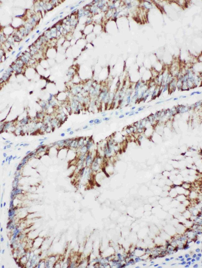 MEKK1 Antibody in Immunohistochemistry (Paraffin) (IHC (P))