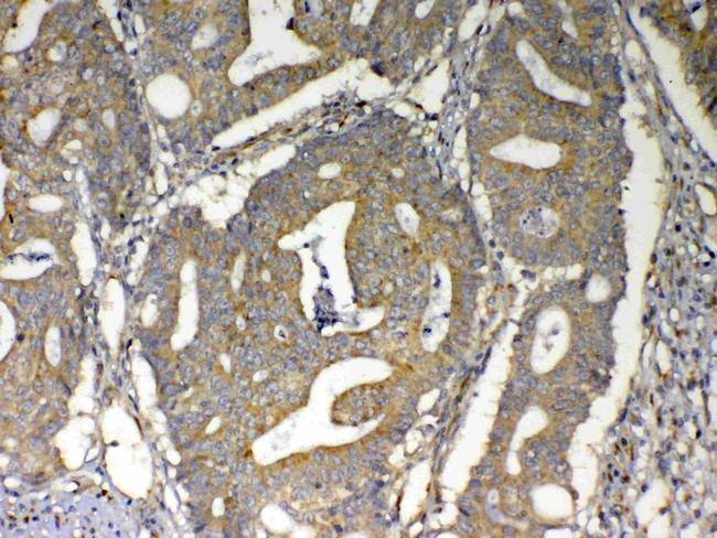 MAVS Antibody in Immunohistochemistry (Paraffin) (IHC (P))