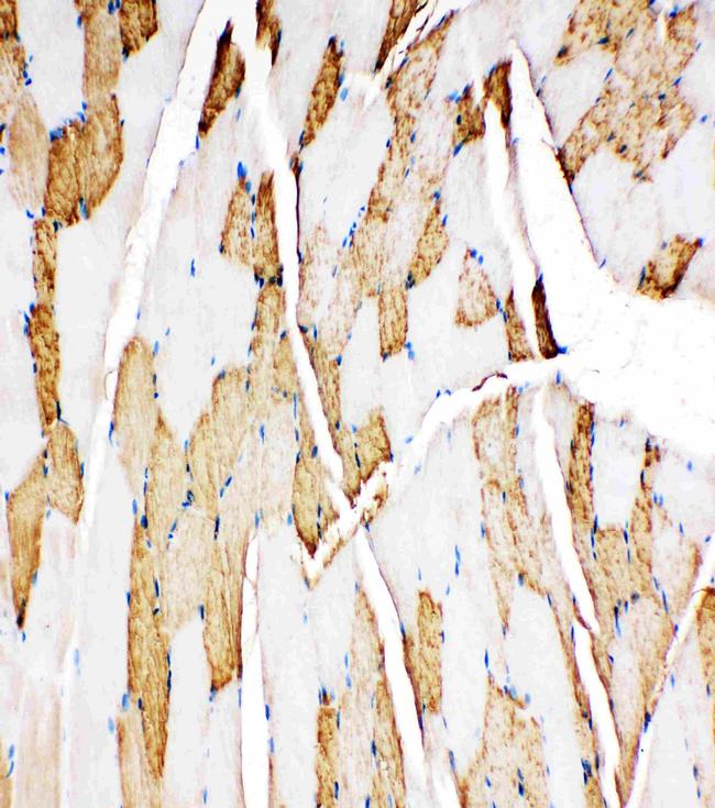 Myoglobin Antibody in Immunohistochemistry (Paraffin) (IHC (P))