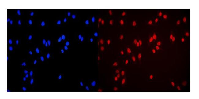 MCM3 Antibody in Immunocytochemistry (ICC/IF)