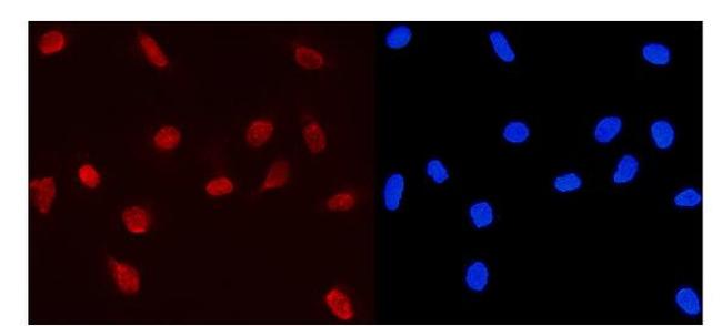 MCM5 Antibody in Immunocytochemistry (ICC/IF)