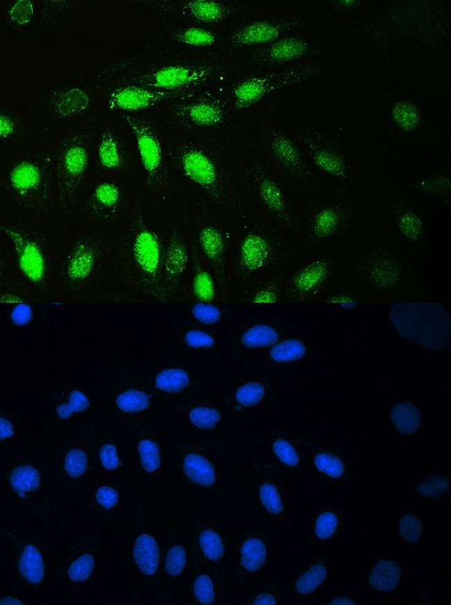 MCM7 Antibody in Immunocytochemistry (ICC/IF)