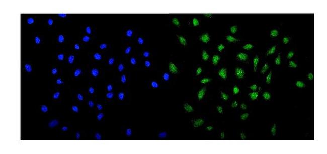 MED13 Antibody in Immunocytochemistry (ICC/IF)