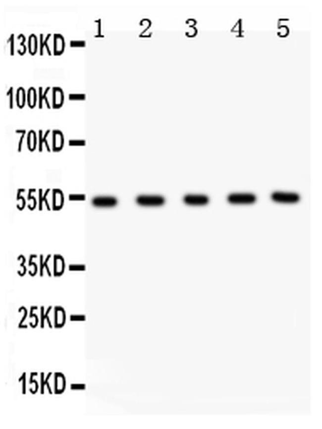 MMP3 Antibody in Western Blot (WB)