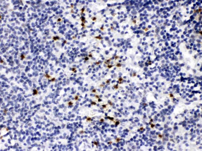 MMP9 Antibody in Immunohistochemistry (Paraffin) (IHC (P))