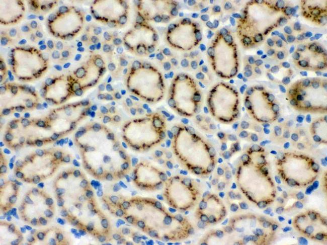 MMP9 Antibody in Immunohistochemistry (Paraffin) (IHC (P))