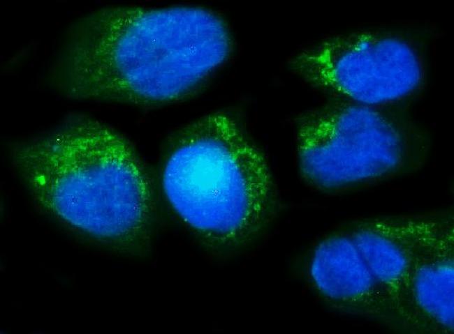 MUT Antibody in Immunocytochemistry (ICC/IF)