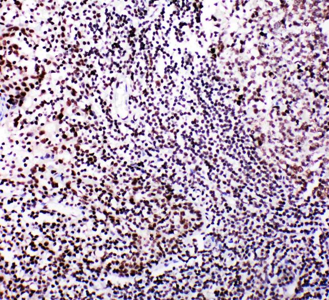 B-Myb Antibody in Immunohistochemistry (Paraffin) (IHC (P))