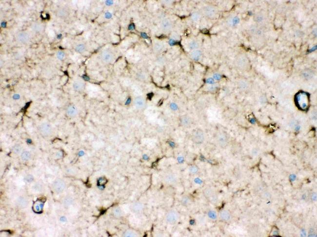 NDRG2 Antibody in Immunohistochemistry (Paraffin) (IHC (P))