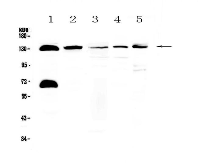 NEDD4L Antibody in Western Blot (WB)