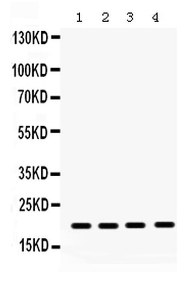 NME1 Antibody in Western Blot (WB)