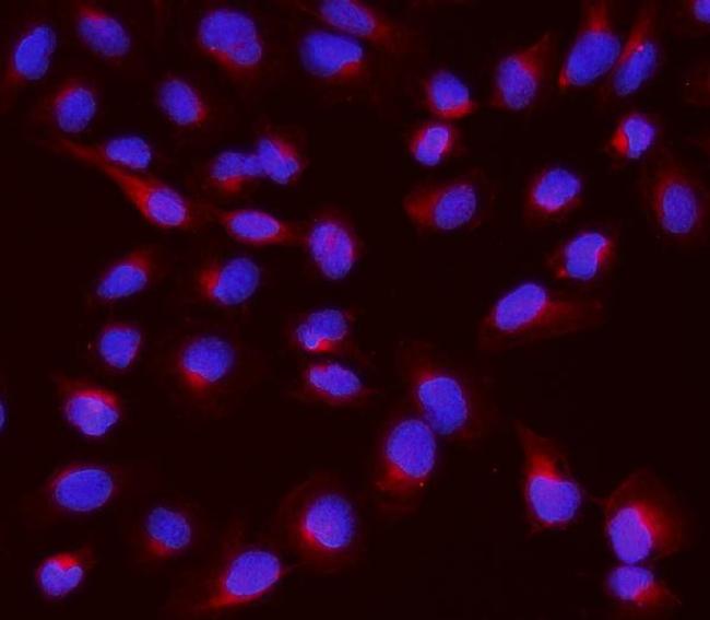 NME2 Antibody in Immunocytochemistry (ICC/IF)